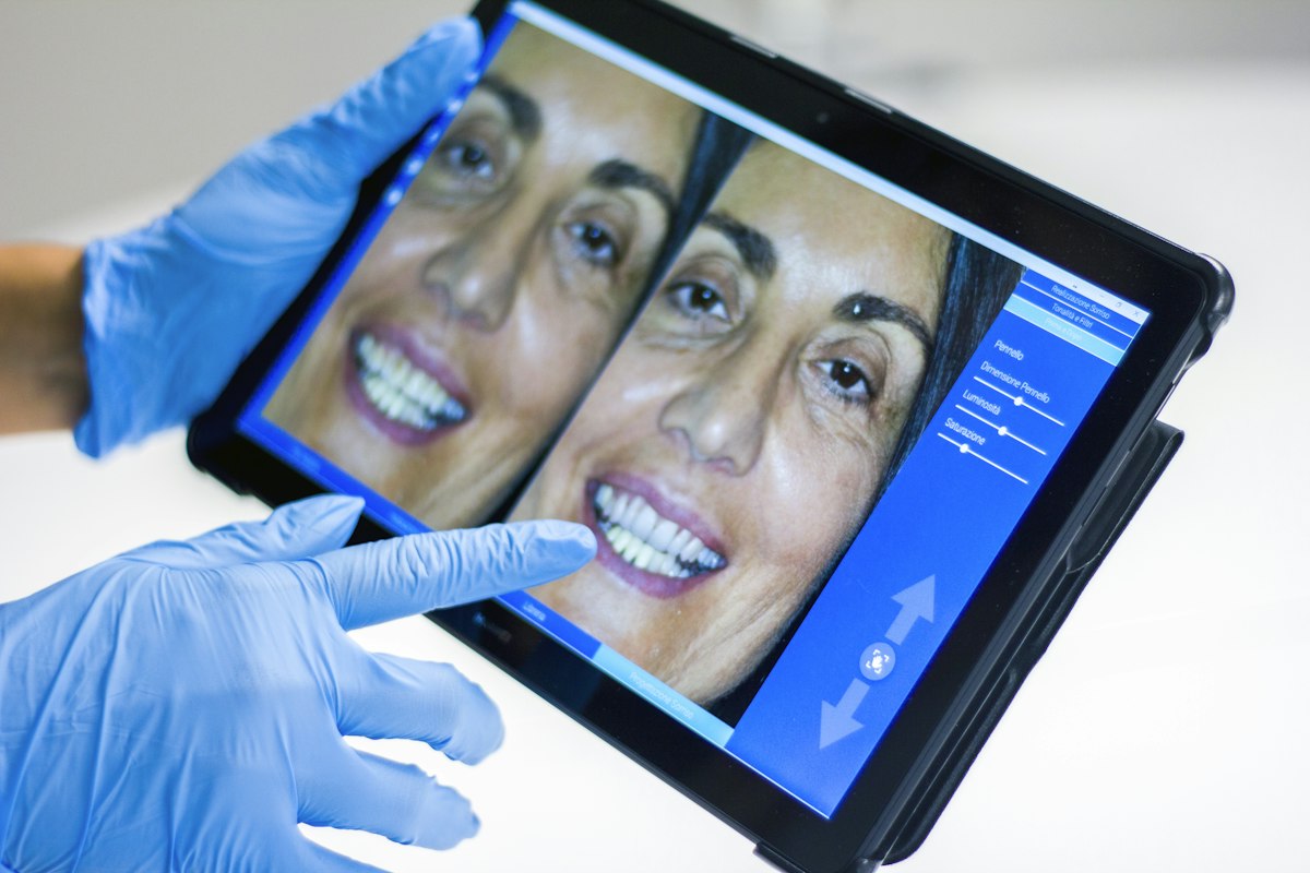 Digital Smile Design